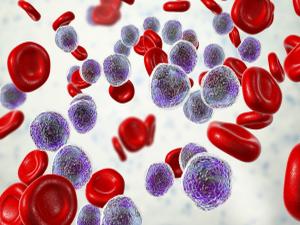 Hematology-Oncology-300x200 Haemato-Oncology